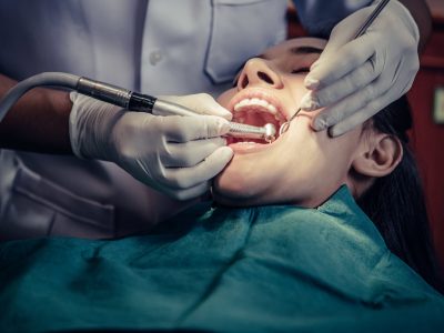 curatare canal dentar